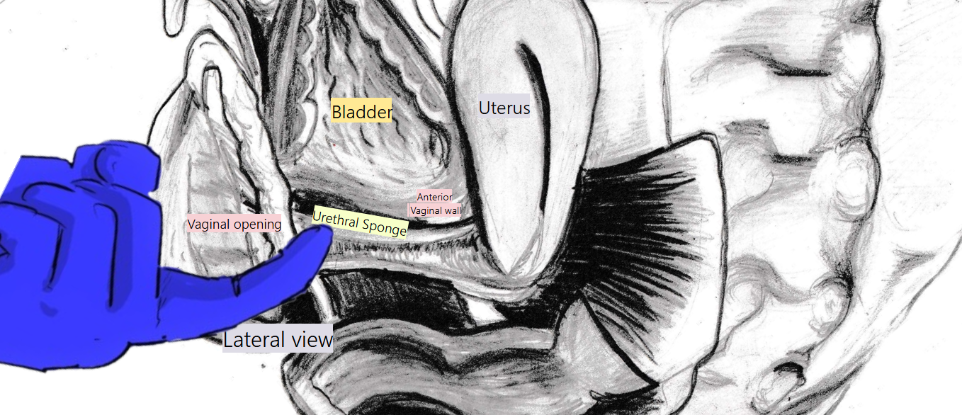 urethral-sponge Urethral-sponge